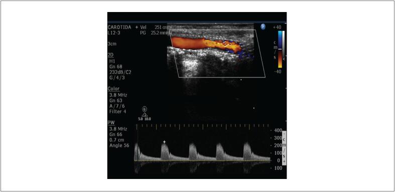 Figure 13