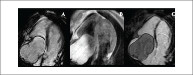 Figure 15