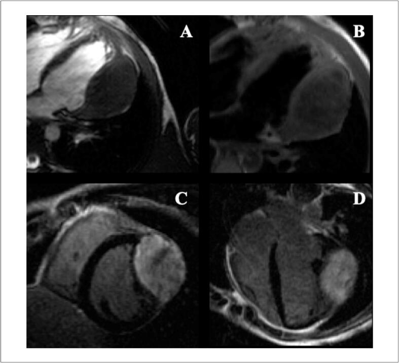 Figure 18