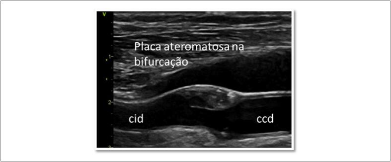 Figura 11