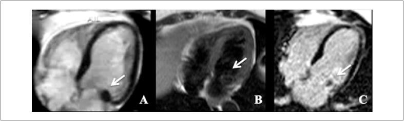 Figure 16