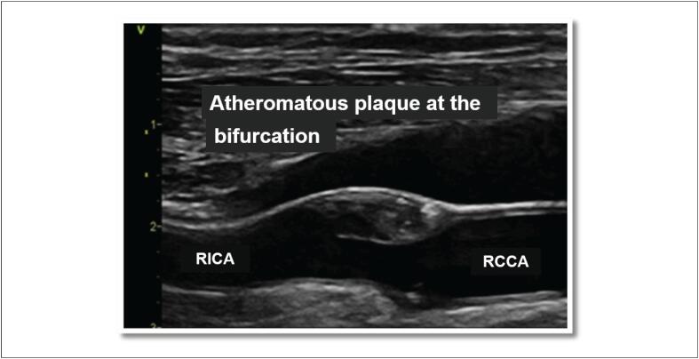 Figure 11