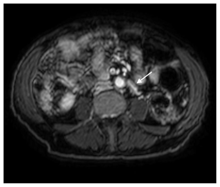 Figure 12