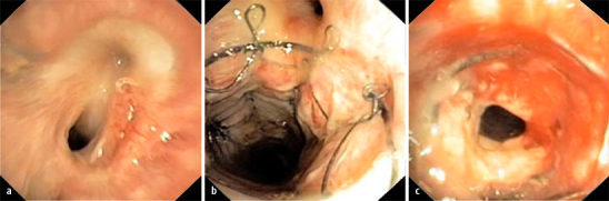 graphic file with name 108_2008_2271_Fig5_HTML.jpg