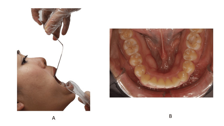 Figure 21