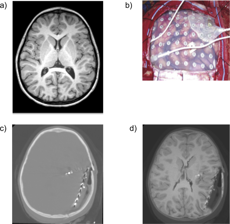 Figure 13.