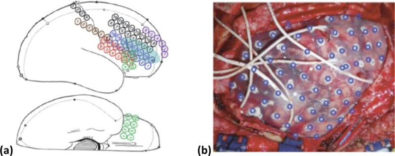 Figure 12.