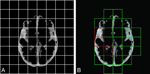 Fig 2.