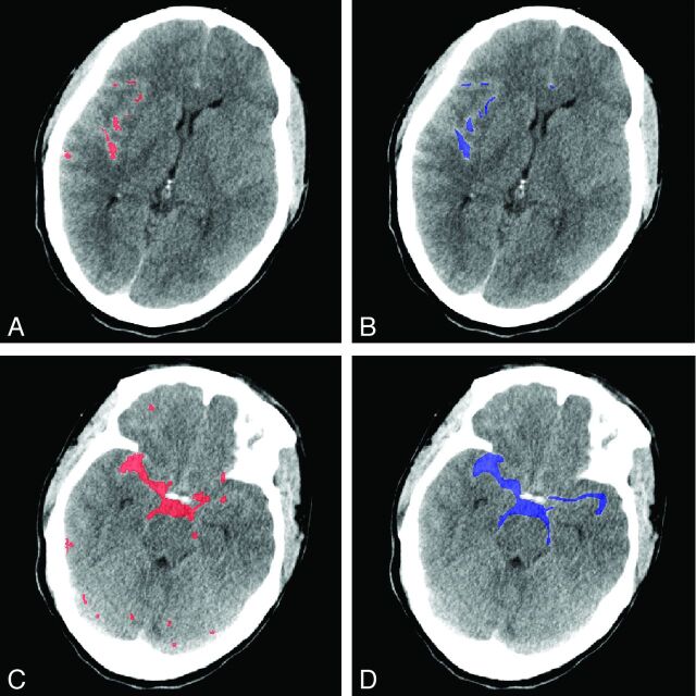 Fig 5.