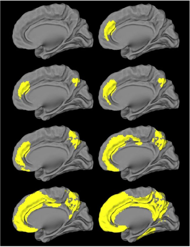 graphic file with name awv112fig1g.jpg