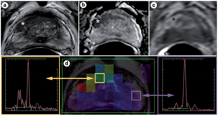 Figure 1 |