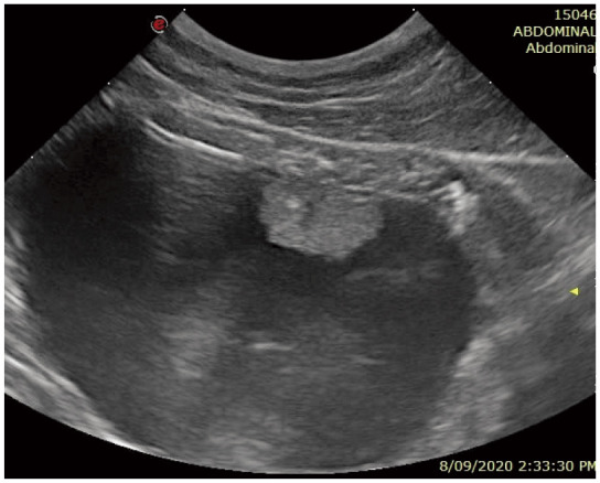Figure 31