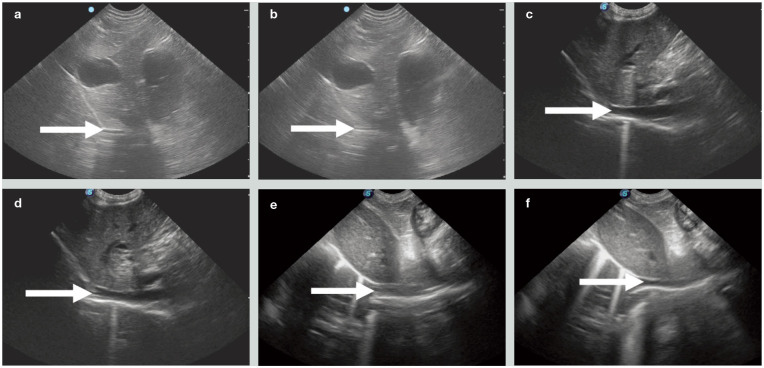 Figure 17