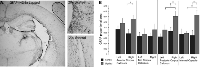 In vivo magnetization transfer MRI shows dysmyelination in an ischemic ...