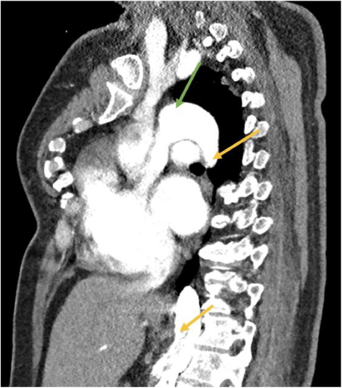 Fig 2: