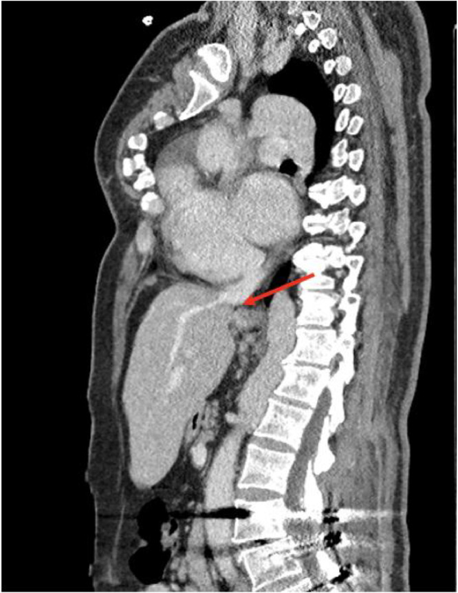 Fig 3: