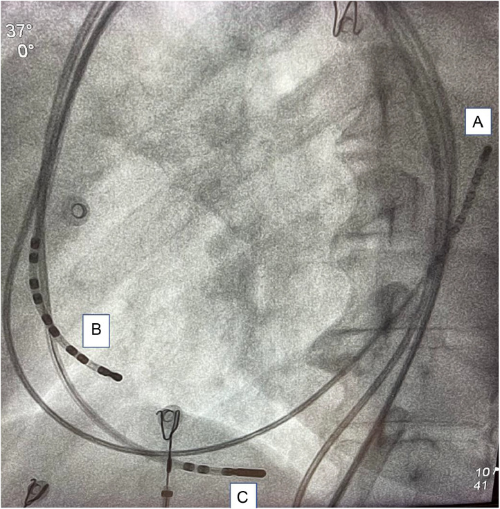 Fig 6: