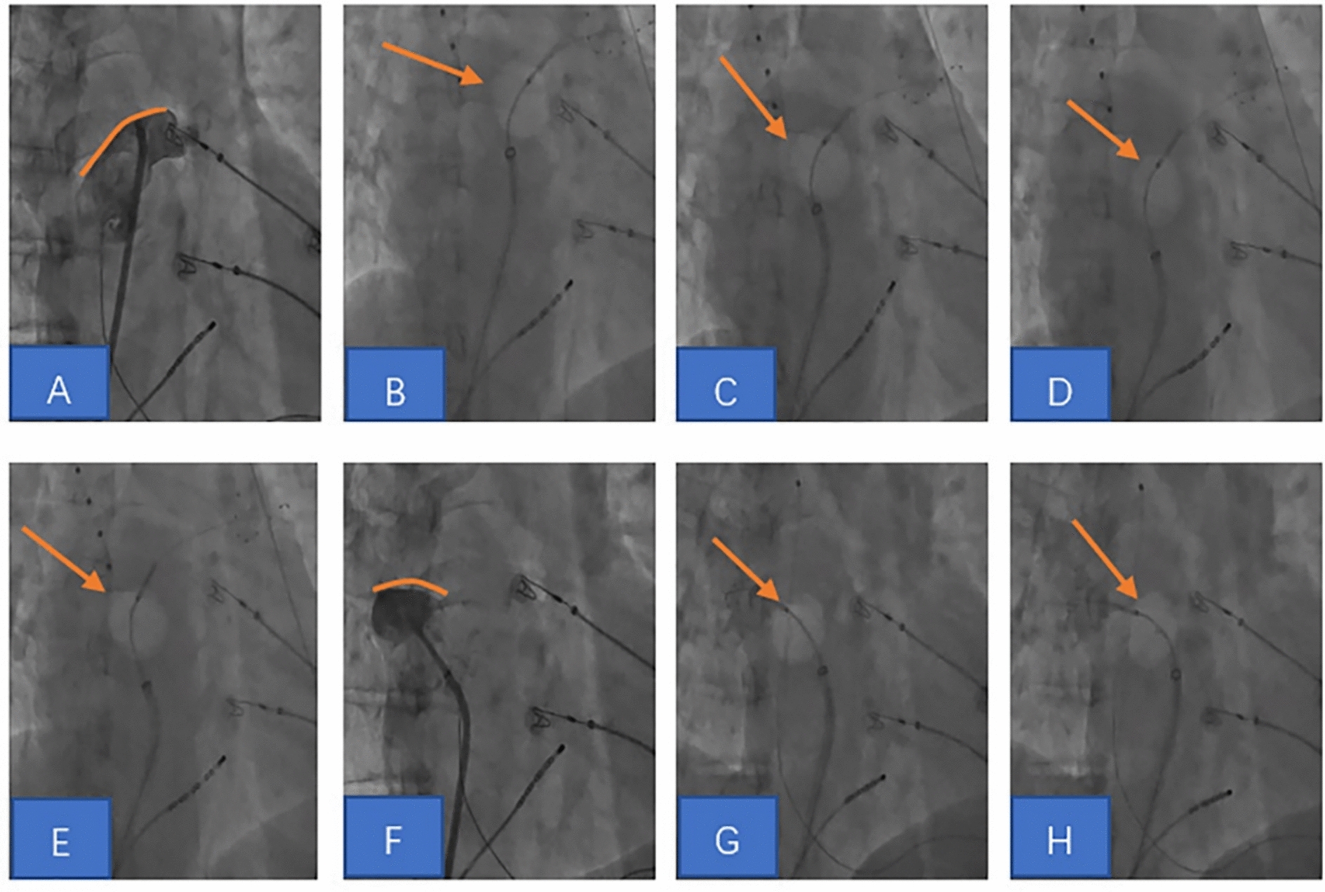 Fig. 2