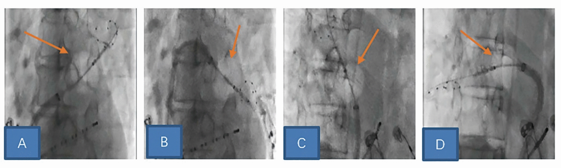 Fig. 1