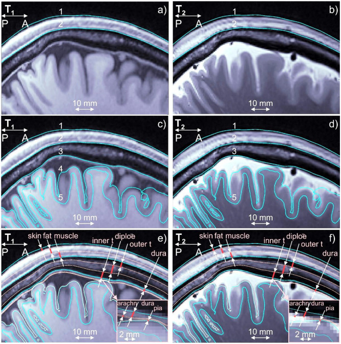 Fig. 2: