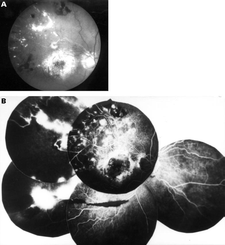 Figure 2  