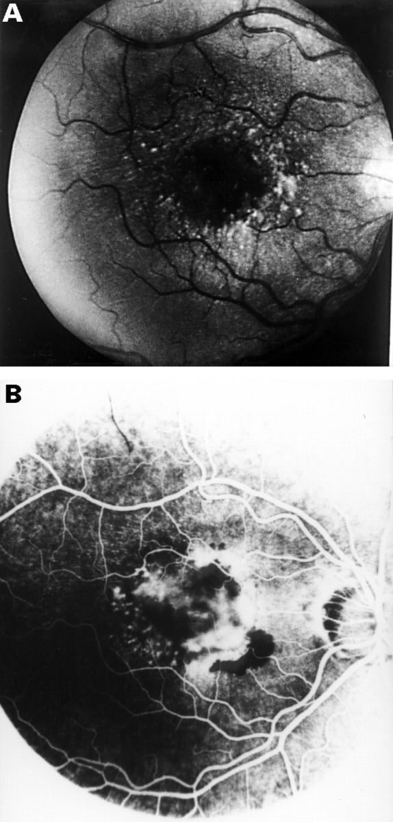 Figure 1  