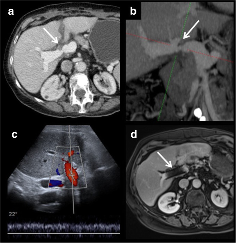 Fig. 11