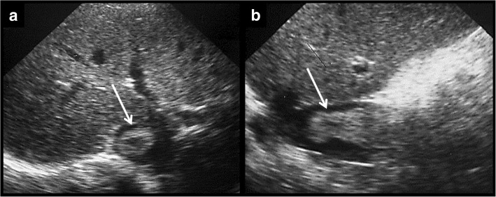 Fig. 12