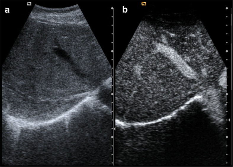 Fig. 14