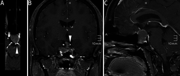 FIG. 1.