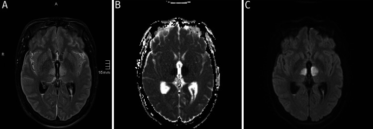 FIG. 2.