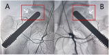 Fig. 4