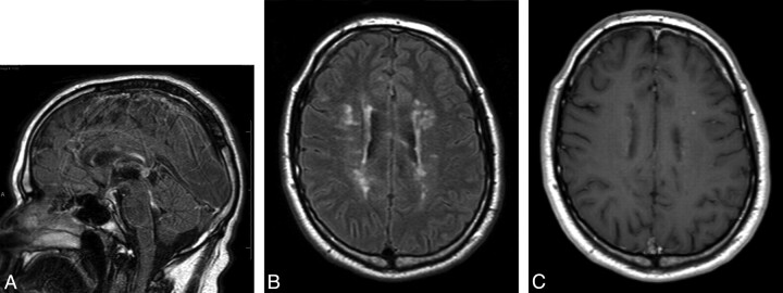 Fig 4.