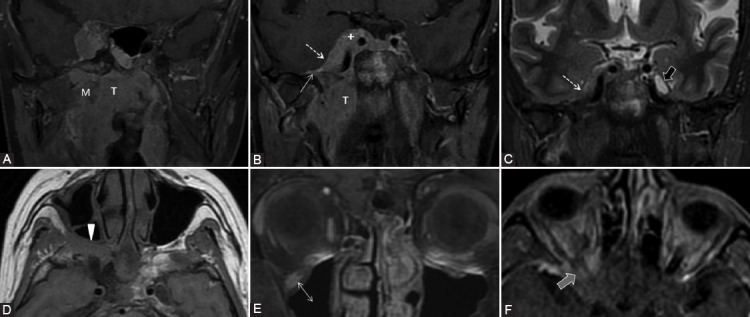 FIGURE 13