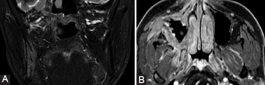 FIGURE 17