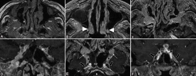 FIGURE 19