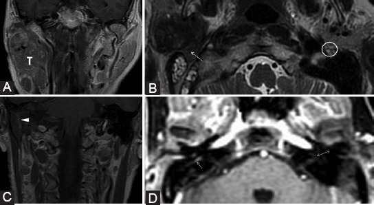 FIGURE 12