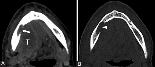 FIGURE 11