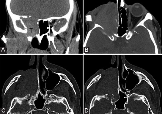 FIGURE 16