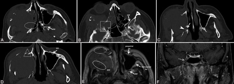 FIGURE 14