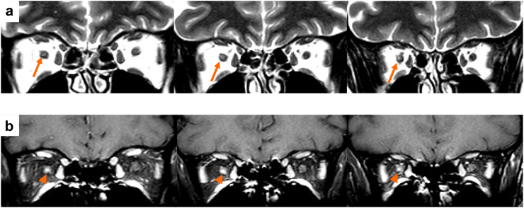 Fig. 3