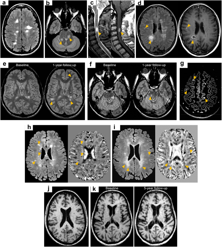 Fig. 4