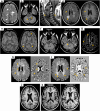 Fig. 4