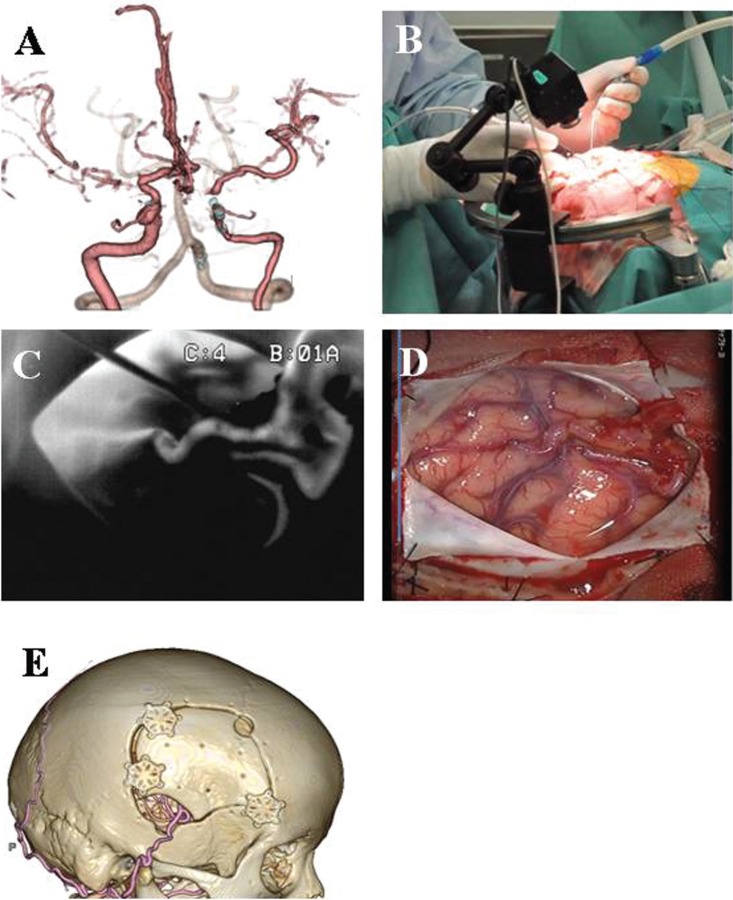 Fig. 2.