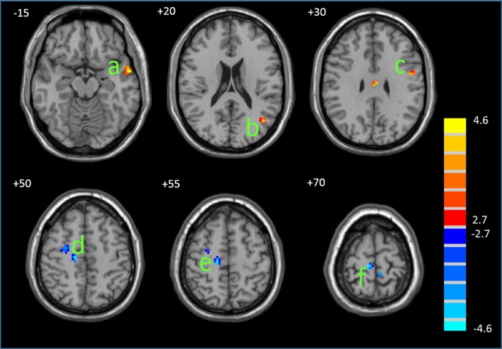 Fig 3