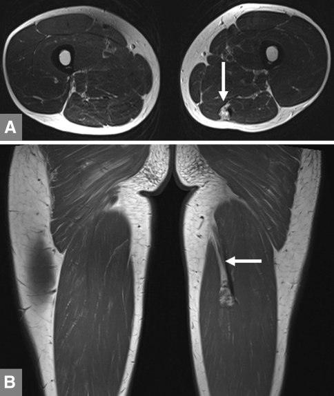 Fig. 3A–B