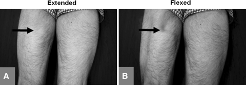 Fig. 1A–B