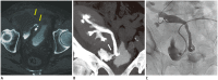 Fig. 12