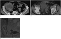 Fig. 11