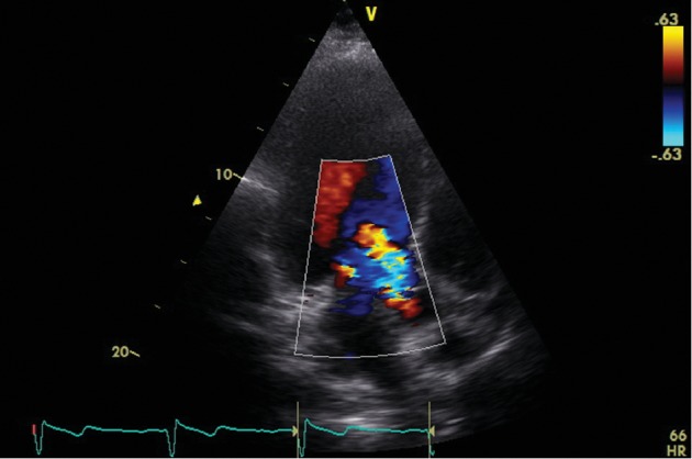 Figure 2